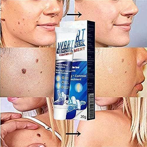 Wart Removal Ointment Cream Common Wart for Body Skin Tag Remover and Face Skin Tag Remover